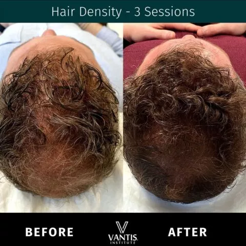 before and after gallery item