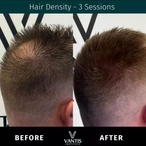 before and after gallery item