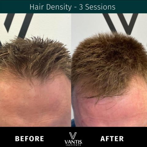 before and after gallery item