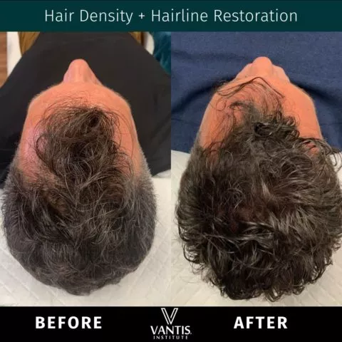 before and after gallery item