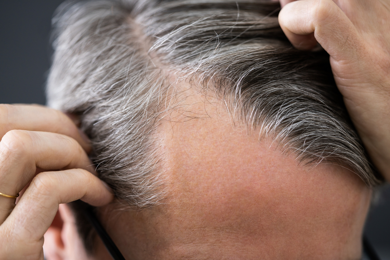 5 Reasons Your Hair Loss is Sabotaging Your Life | Vantis Institute Vantis  Institute