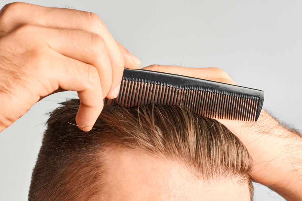 A man combs his receding hairline